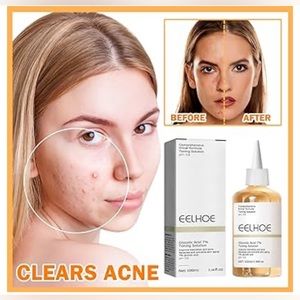 100ML Glycolic Acid 7% Toning Resurfacing Solution,Facial Exfoliation 2 box